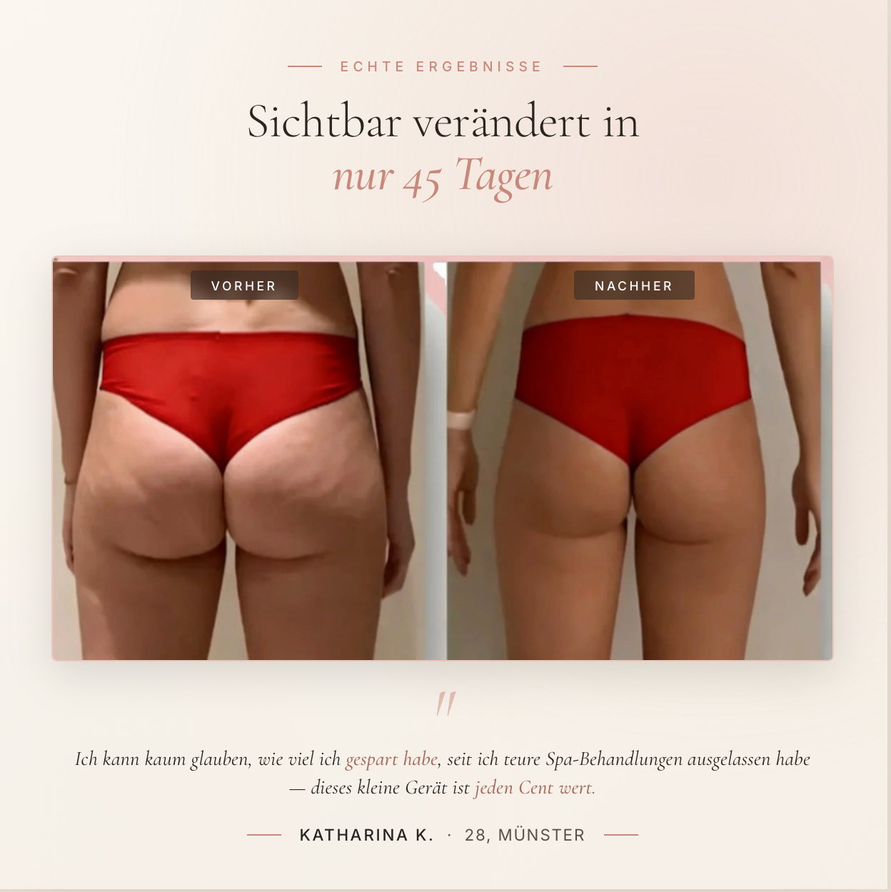 Das Evelune Ritual — Elektrisches Schröpfgerät & Anti-Cellulite Öl