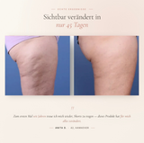 Das Evelune Ritual — Elektrisches Schröpfgerät & Anti-Cellulite Öl